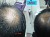 GrowFar Hair Care Centre