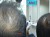GrowFar Hair Care Centre